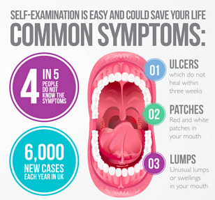 oral cancer screening